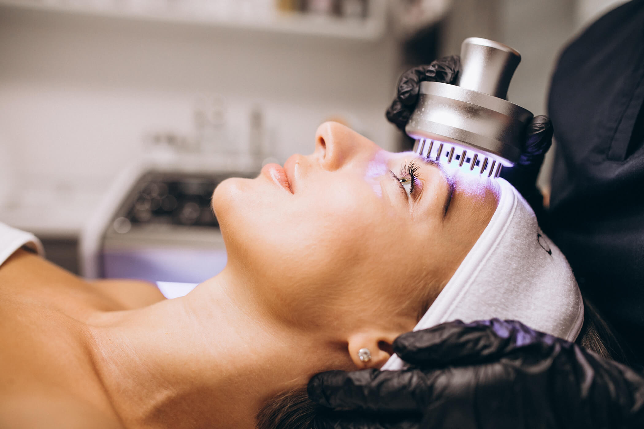 Laser Treatment for Acne Scare What expect, Cost, and More